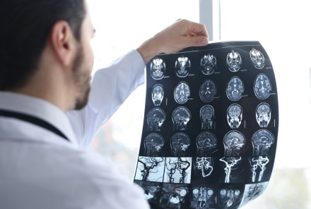 Secondary Brain Injury: When Recovery Goes Off Track