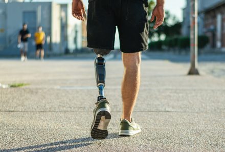 What you need to know about lower limb prostheses and factors that drive up costs