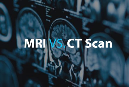 Head Injuries: MRI’s or CT Scans – Which is Better for Workers’ Compensation Cases?