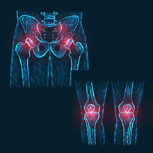KneeHipWebinarSM