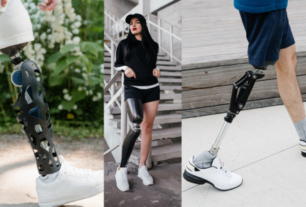 Determining Medical Necessity: How Many Prosthetics Does an Injured Worker Need?