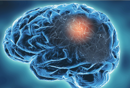 Cognitive Decline and Decision-Making Challenges in Aging Injured Workers